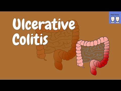 Ulcerative colitis [Pathophysiology, Gross & Microscopic morphology, Toxic megacolon]