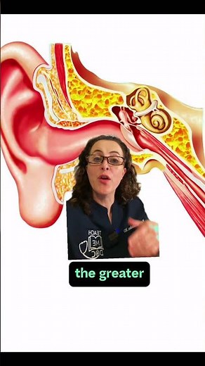 🧏 Sudden Sensorineural Hearing Loss (SSNHL) is the sudden loss of hearing for no apparent reason.