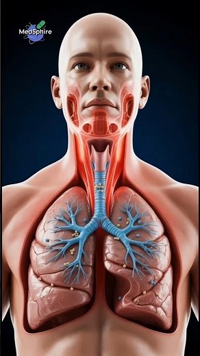 How Tuberculosis (TB) Destroys Your Lungs | 3D Medical Animation #shorts