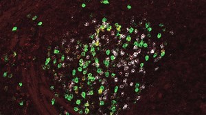 How does the brain process fear? | Cold Spring Harbor Laboratory