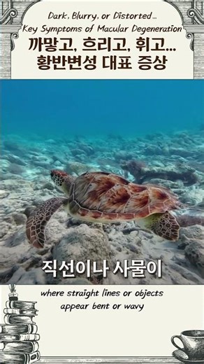 황반변성 증상 세 가지