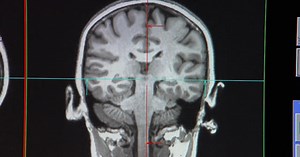 How MRI scans are showing scientists the physical makeup of our thoughts