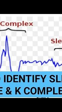 Sleep spindle and K complex on EEG