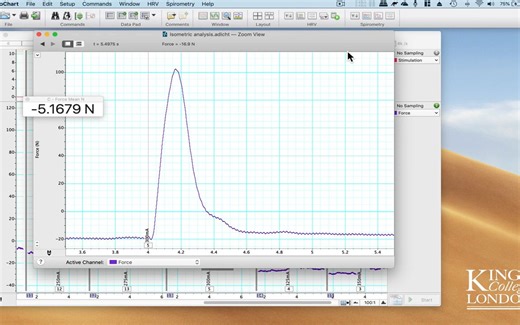 Extracting and Plotting data with a variable baseline in LabChart to Prism