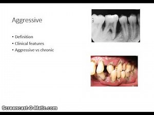 Perio Week 1 Ch 1-4 Part 5 Classification of Periodontal Diseases