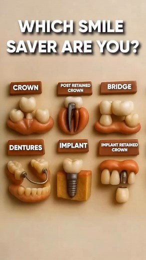 🦷 Which smile saver are you? 😁 Whether it’s a crown, bridge, implant, or dentures, modern dentistry has your back (and your bite)! Each of these dental solutions helps restore your smile, chewing ability, and confidence, while also protecting your oral health. Here’s a quick breakdown 👇 ✨ Crown: Covers and protects a weak or damaged tooth. 🦾 Post-Retained Crown: Reinforces a tooth after root canal treatment. 🌉 Bridge: Replaces one or more missing teeth by anchoring to neighboring ones. 🦷 I