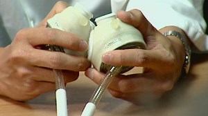 Father receives full artificial heart in UK first