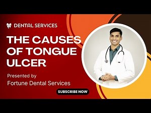 THE CAUSES OF TONGUE ULCER | Fortune Dental Services