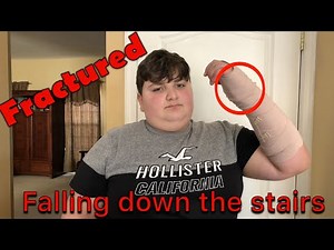 How I broke my arm