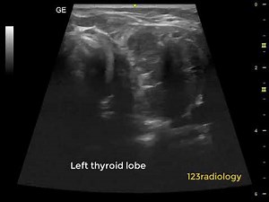 Ultrasound Case 06