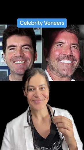 #greenscreen #simoncowell #DenverCO #Denverdentist #denver #smilestudiodental #dentaltok #teethtok #dentaltiktok #dentisttiktok #dentistry #dentalassistant #dentalhygienist #teeth #toothtok #Colorado #coloradodentist