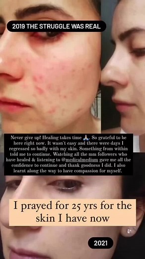 Medical Medium on TikTok