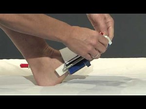 Wearing the Hallux Valgus Dynasplint® System