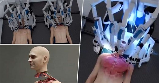 World's first head transplant system: US-based startup's spine-chilling, graphic video shocks Internet (WATCH)