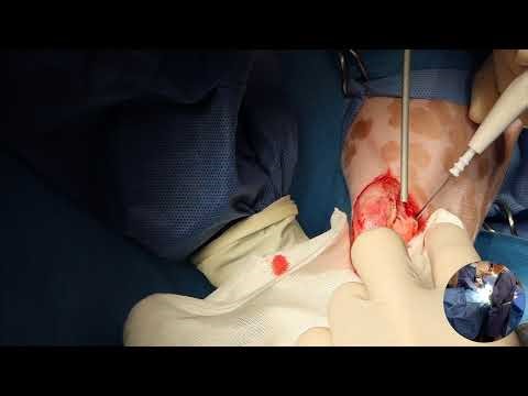 Medial patellar luxation in a dog