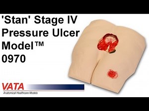 0970 - 'Stan' Stage IV Pressure Ulcer Model™