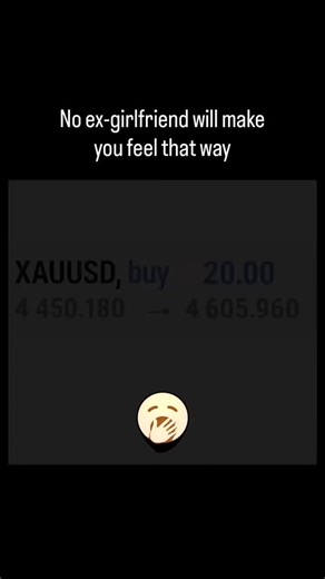 Till the end… ☠️ . . #trader #daytrading #trading #xᴀᴜᴜsᴅ | Ferdinand Tong-French Trader