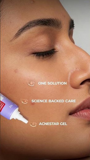 AcneStar Gel targets the spot, helping heal breakouts without changing your daily routine.