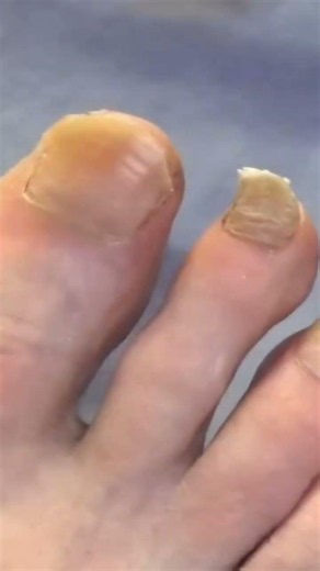 I've heard of the tooth fairy, but never the toenail fairy. I was intimidated about trimming a nail