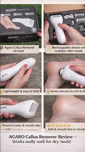 Smooth Feet in Minutes | Agaro Callus Remover Review #agaro #ytshorts
