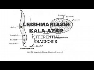 8.LEISHMANIASIS-DIFFERENTIAL DIAGNOSIS