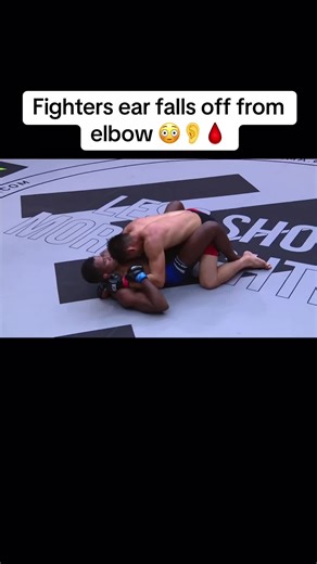 Wow 😯 #mma #injury #fighter #viral_video_tiktok2021 | cruz vs esengulov ear