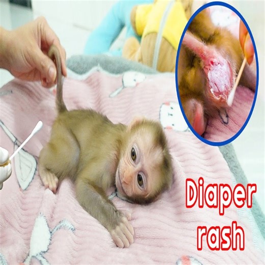 2.2K views · 56 reactions | Baby Monkey Sunny has a diaper rash and feels uncomfortable #reels #reelfb #funny #fyp #adorable #animal #monkey #babymonkey #MonkeyBaby #monkeys #animals | LaLa Monkey | Facebook