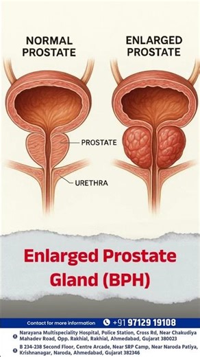 Are you facing urinary problems?
