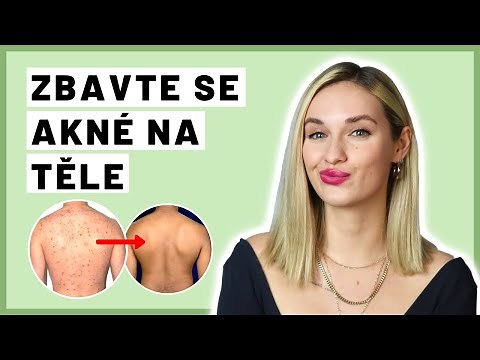 Jak se zbavit akné na těle | KOMPLETNÍ NÁVOD