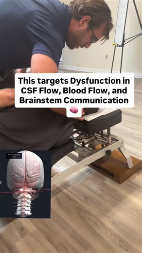 Upper Cervical Chiropractor Near Me on Instagram: "This Adjustment targets dysfunction in CSF Flow, Blood Flow, and Brainstem Communication all of which can cause a variety of symtoms like POTS Dizziness Migraines Vertigo Brainfog and Vagus Nerve Issues. Comment help for a doctor near you! #dizziness #pots #vagusnerve #fyp"