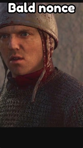 Bald nonce back at it again