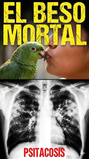 Clever Oblitas: CSSNARRACIONES on Instagram: "Piensas que es amor... pero te está cerrando los pulmones. 🦜💋🦠 Los loros cargan Chlamydia psittaci. Respirar su polvo causa Neumonía Atípica. 🫁☠️ Los médicos la confunden con gripe y te ahogas por dentro. Desliza para ver la radiografía. 👇 #Psitacosis #Loros #Salud #Peligro #Pulmones"