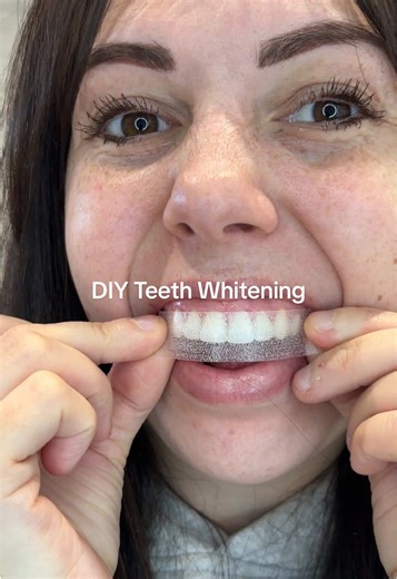 DIY Teeth Whitening Techniques for a Bright Smile