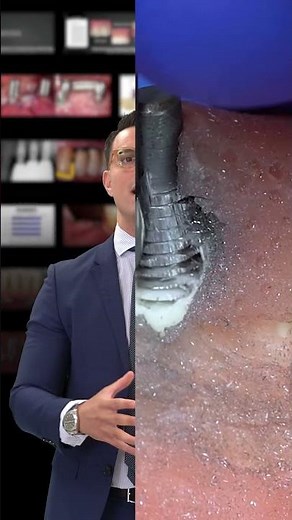 Dr. Alberto Monje | Management of Peri-implantitis | Online Course 2024 #periodontist #shorts