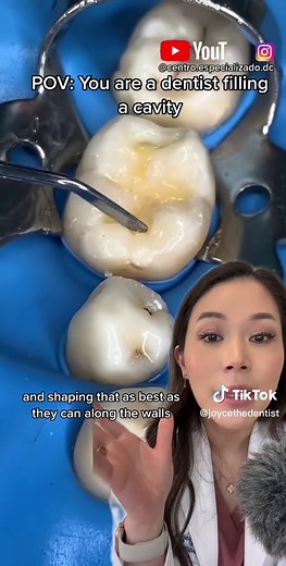 Creative Ways to Treat Cavities: A Dentist's Guide