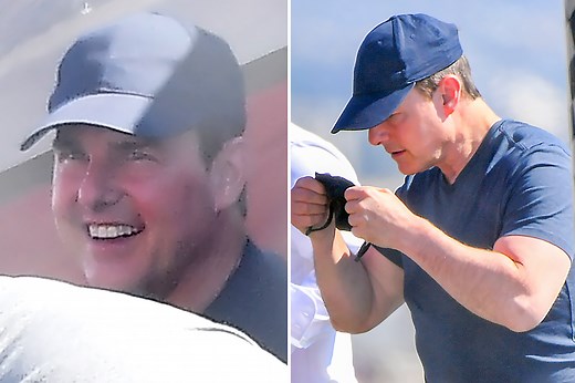 Tom resurfaces with puffy face after unrecognizable appearance at baseball game