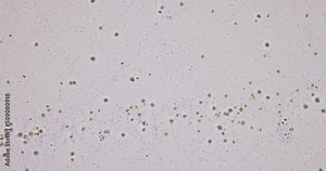 Bacteria and Protozoa in waste water under the microscope.