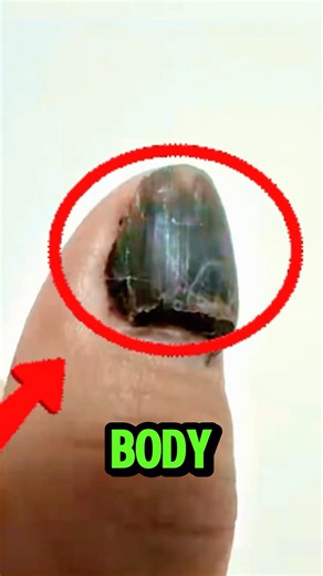 What Happens After You Smash Your Nail? #shorts