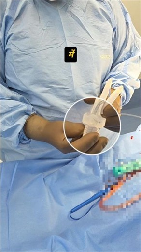 3 Piece Penile Implant Deflate Kaise Hota Hai? | Rigicon Infla10 | AMS 700