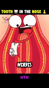 Do you know how a tooth can grow inside a child’s nose? 😮 In rare cases, a tooth forms in the wrong place during early embryo development. This is called an ectopic tooth. Early diagnosis and simple surgery can fix it safely. Save this & Follow Healthy Toon Hub for more fun health facts & animation! 💚 - - - - #FacebookReels #ViralReels #ReelsTrending #HealthFacts #MedicalFacts #HealthAnimation #DidYouKnow #MedicalCuriosity #GlobalHealth #USAHealth #reelstrending #facebookreels #DidYouKnow | He