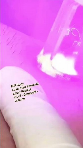 The Truth About Men's Intimate Laser Hair Removal Nobody Tells You!#hair #skincare #love