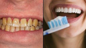 Dentist says there are three mistakes people make throughout the day that are turning your teeth yellow