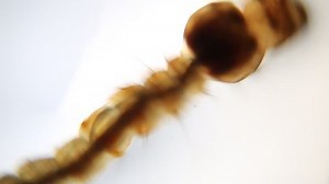 clip-27030904-mosquito-larva-under-microscope-view