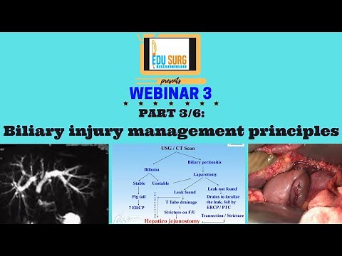 Biliary injury management - Principles - Dr. Prasad Wagle - Safe laparoscopic cholecystectomy