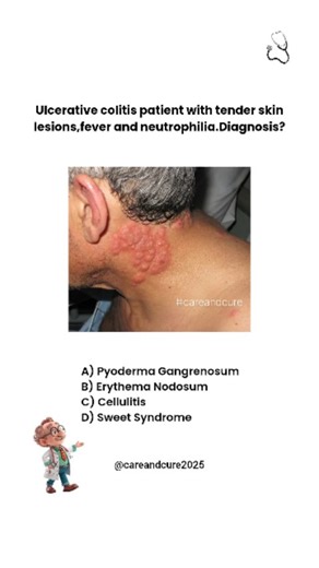 CareAndCure on Instagram: "UC patient + this triad = ❓ For the essential internship survival tips,Grab my Guide at the link in my bio! INSIDE "THE INTERNSHIP SURVIVAL GUIDE" 🔥 Battling Burnout - Protect your mental health. 🤖 AI on the Wards - Work smarter, not harder. 🛡️ The Core Survival Toolkit - Your daily workflow, mastered. 🎯 Securing Your Future - How to stand out and get the job. + 5 more essential chapters! Follow @careandcure2025 for more #Medical and #Health related content. This c
