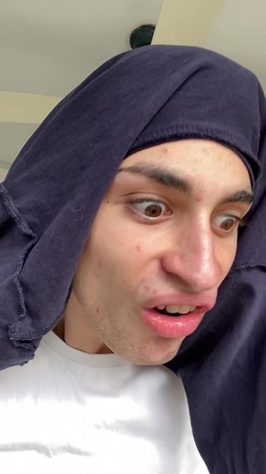 El sapito y su humor cómico