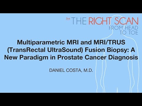 Multiparametric MRI and MRI/TRUS (TransRectal UltraSound) Fusion Biopsy