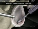 PushLock® Cinch Stitch with FiberLink™