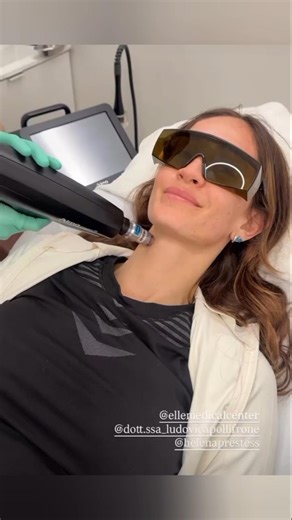 HELENA PRESTES fa il laser Q switch da Mavi Minghetti ♥️