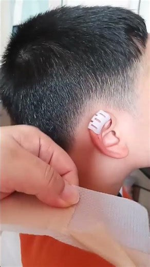 Baby Ear Molding Corrector Clip Newborn, Children Ear Corrector Infant